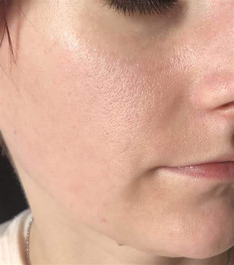 Routine Help Am I On The Right Track Main Concerns Are Pores