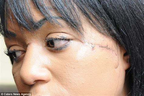 Devastated Models Career Ended After Yob Smashes Her Face Through A
