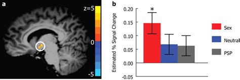 Encoding Human Sexual Chemosensory Cues In The Orbitofrontal And