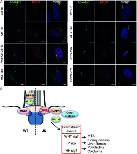 Mks1 Mutations Associated With Joubert Syndrome Js Do Not Alter Mks1