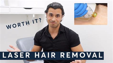Male Hair Removal London 30 Off Laser Hair Removal Greater London