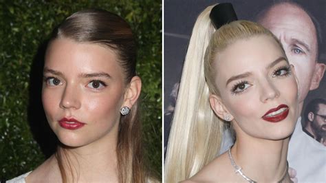 Did Anya Taylor Joy Get Plastic Surgery Quotes Photos Life And Style