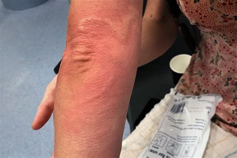 Teacher Considers Scarification To Retain Potentially Deadly Box