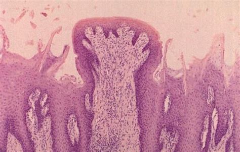 Fungiform Papillae Google Search Medical Illustration Histology Slides Anatomy And Physiology