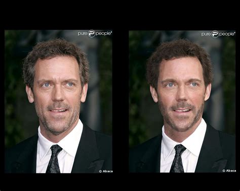 Stroke The Smoke Hugh Laurie Beforeafter