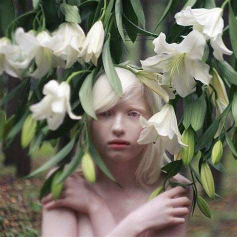 Nastya Zhidkova Albino Model Portrait Albino Human