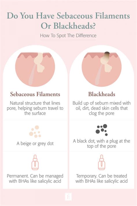 Sebaceous Filaments Vs Blackheads Whats The Difference Skin Care