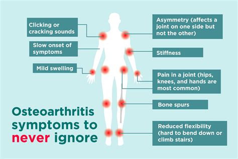 8 Early Signs Of Arthritis You Should Never Ignore Eslkevins Blog