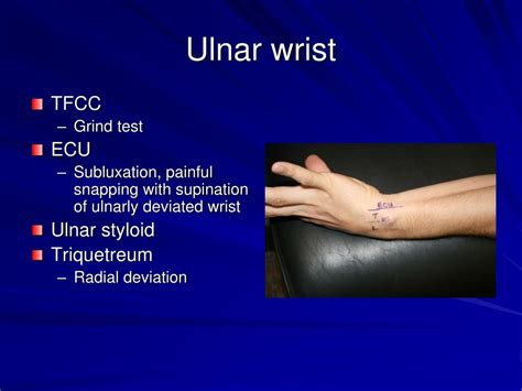 Ppt Examination Of The Hand And Wrist Powerpoint Presentation Free