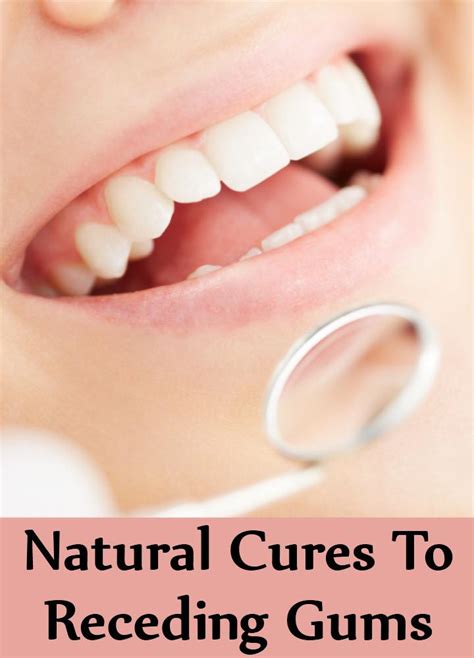 Best 9 Natural Cures To Receding Gums How To Cure Receding Gums