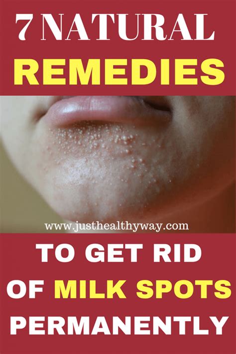 7 Natural Remedies To Get Rid Of Milk Spots Permanently Spot Free Skin