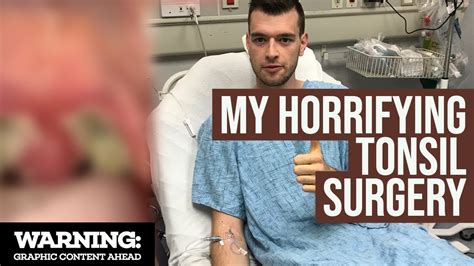 Tonsillectomy Surgery Gone Wrong My Terrifying Experience And