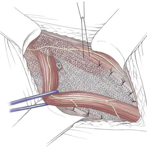 This is also known as the medial compartment of the thigh that consists of the adductor muscles of the hip. Surgical Anatomy of the Groin | IntechOpen