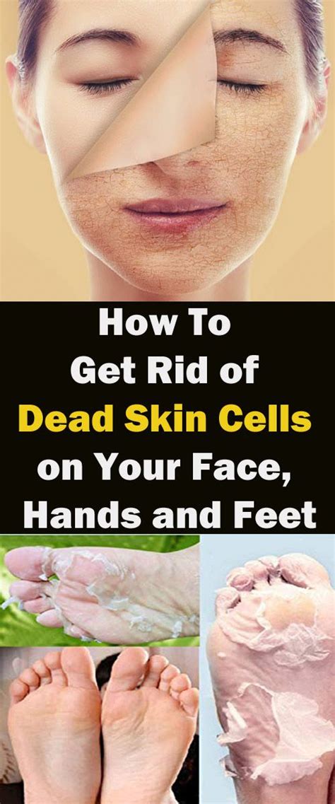 7 Best Ways To Remove And Get Rid Of Dead Skin Cells On Your Face