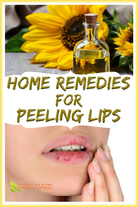 How To Prevent And Cure Dry Chapped Lips Naturally Rough Skin