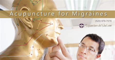 Acupuncture For Migraine Headaches Acupuncture Del Soul