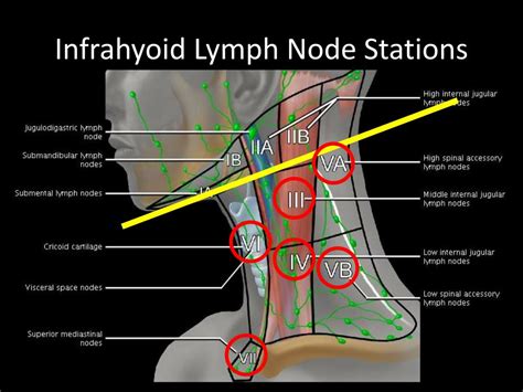 Ppt Case Studies In Infrahyoid Neck Powerpoint Presentation Free