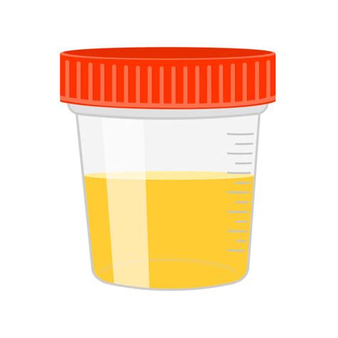 Urine Specimen Cup Illustrations Royalty Free Vector Graphics And Clip