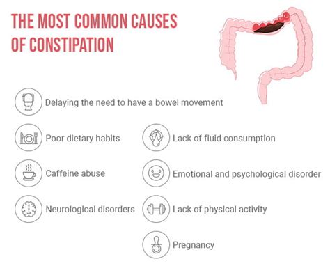 best constipation treatment doctors in upper east side nyc
