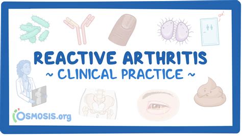 Reactive Arthritis Clinical Sciences Osmosis Video Library