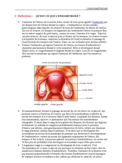 Endometriosis is a disorder in which tissue similar to that which forms the lining of your uterus grows outside of your uterine cavity. ENDOMETRIOSE