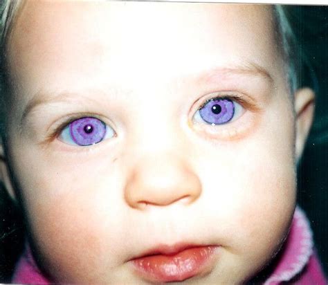 Savannah Purple Eyes 珍しい目の色 ぱっちり目 キュートな瞳