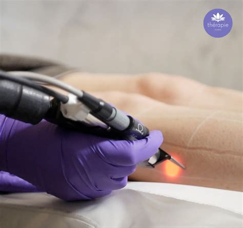 The Dos And Donts Of Laser Hair Removal At Thérapie Clinic Therapie