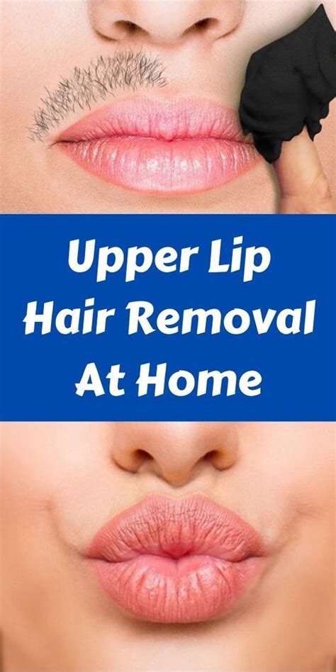 How To Remove Blackhead From Upper Lip Howtoremvo