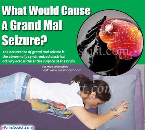What Would Cause A Grand Mal Seizure