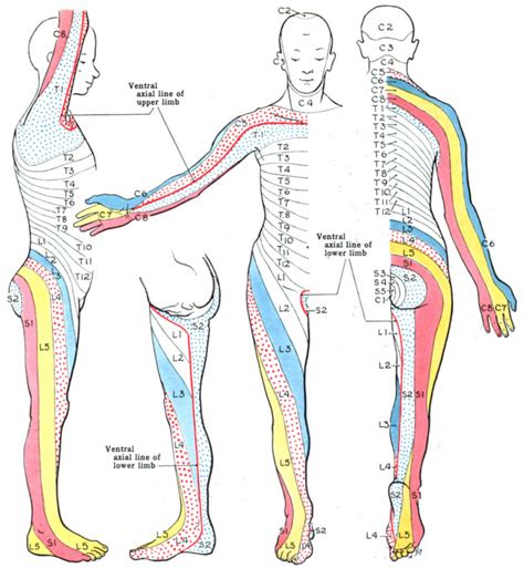 Dermatomes Radiculopathy Spinal Nerve Nerve Porn Sex Picture