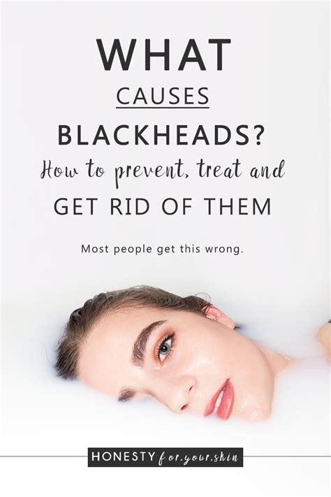 What Causes Blackheads How To Prevent Treat And Remove