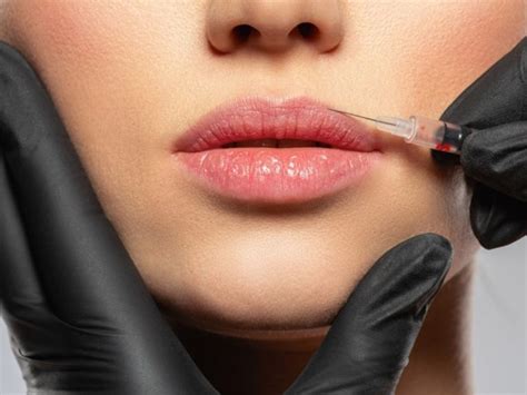 Botox Treatment In Teaneck Nj Call Vanity Medical Spa Now