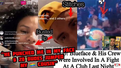 Blufaces Victims Speak Out And Show Their Face Bruises From Jumping By