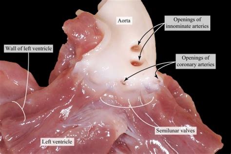 Semilunar Valve Anatomy Hot Sex Picture