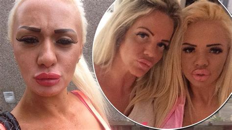 Josie Cunningham Compares Katie Price Obsessed Mum And Daughters Lips To A Swollen Anus