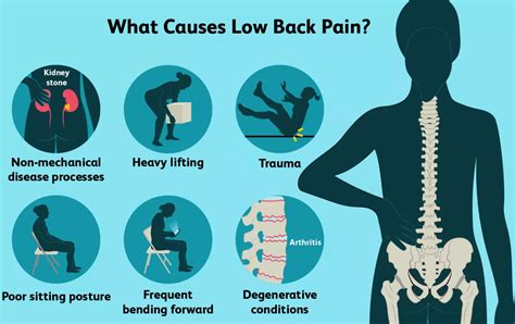 Lower Back Pain Hip Osteoarthritis Drsarumugams Chennai Ortho
