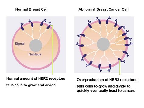 genes the science of breast cancer