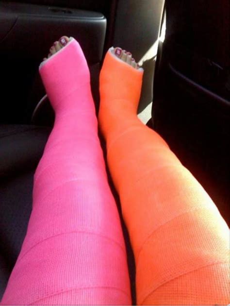 Colourful Casts Rpics