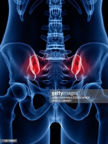Sacroiliac Joint Photos And Premium High Res Pictures Getty Images