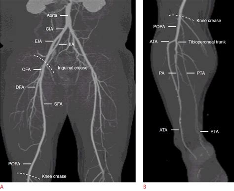 Pin On Ultrasound