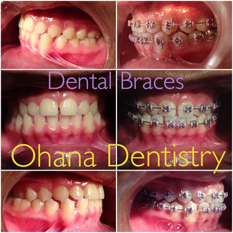 Orthodontics Dentagama