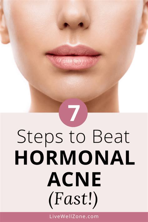 How To Get Rid Of Hormonal Acne Naturally And Reliably A 7 Step Plan For