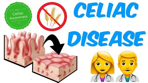 Celiac Disease Youtube