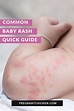 Pics Of Diaper Rash: Understanding The Common Skin Condition In Babies ...
