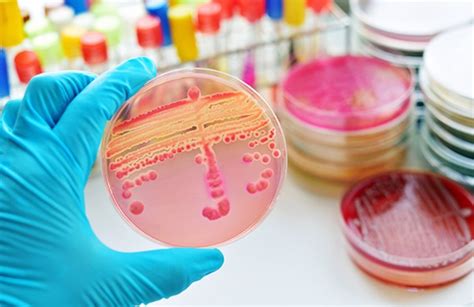 Experto Aboga Por Potenciar Los Servicios De Microbiología De Los