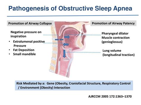 Ppt Upper Airway Pacing For Obstructive Sleep Apnea Powerpoint