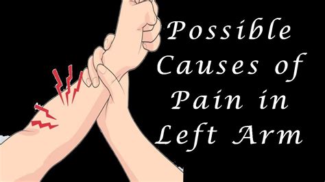 Left Arm Pain Causes Possible Causes Of Pain In Left Arm Youtube