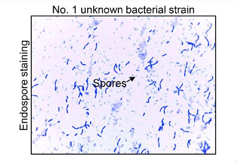 The Endospore Staining Of No 1 Unknown Bacterial Strain Endospore