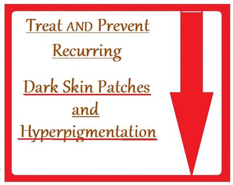 Hyperpigmentation Treatment And Prevention Of Dark Skin Patches Dark