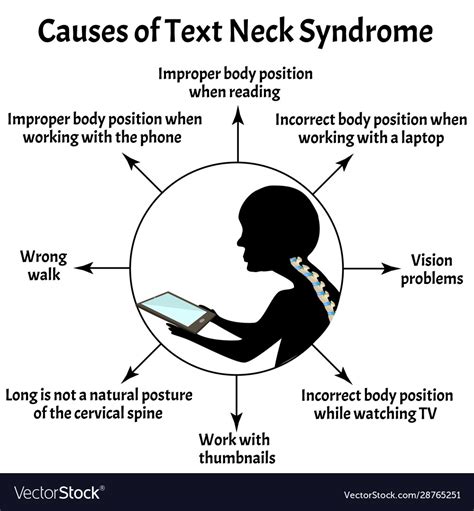 Causes Text Neck Syndrome Spinal Curvature Vector Image